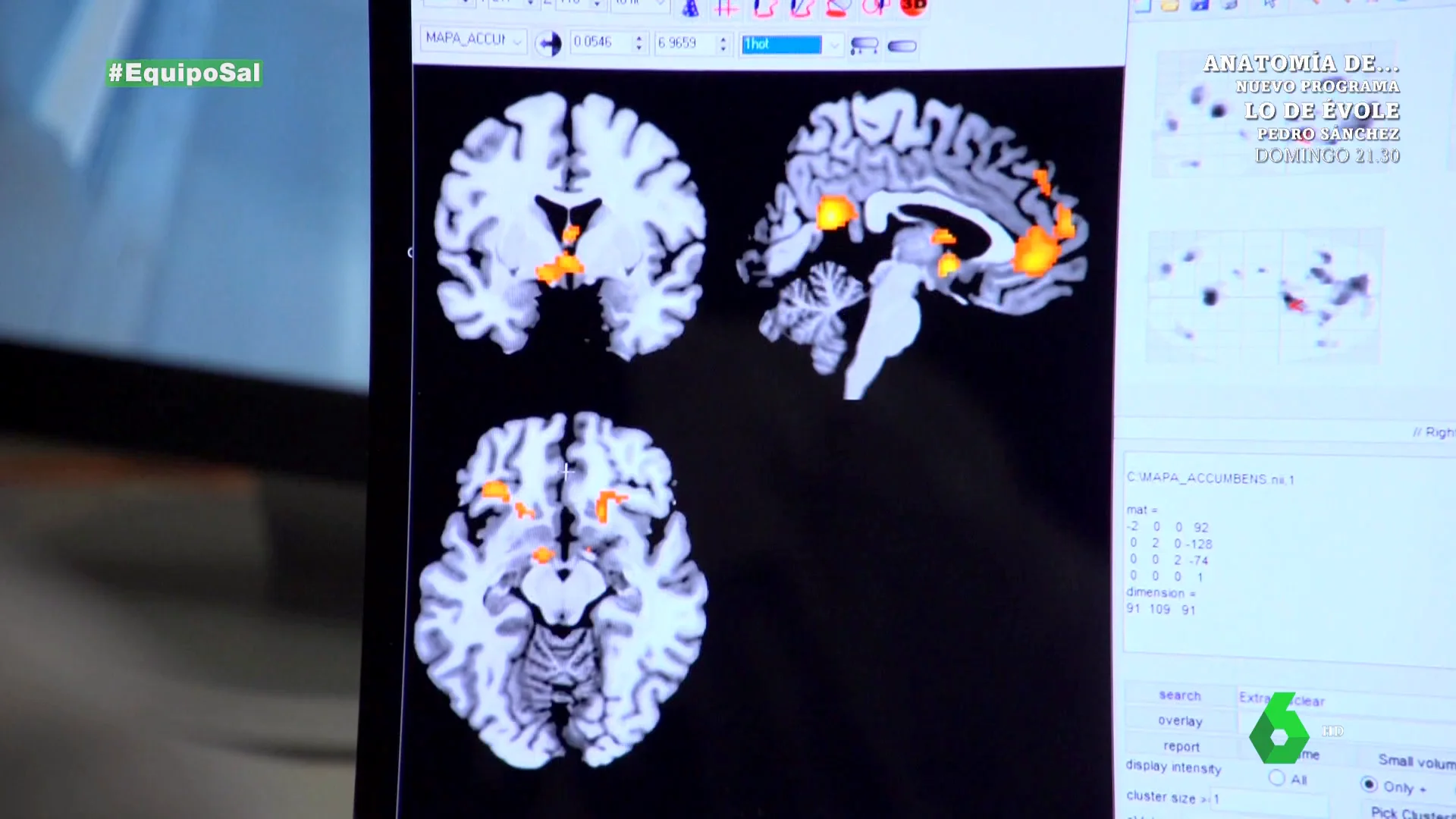 Sexo, cocaína y sal: así reacciona el cerebro ante los consumos "que tienen que ver con el placer"