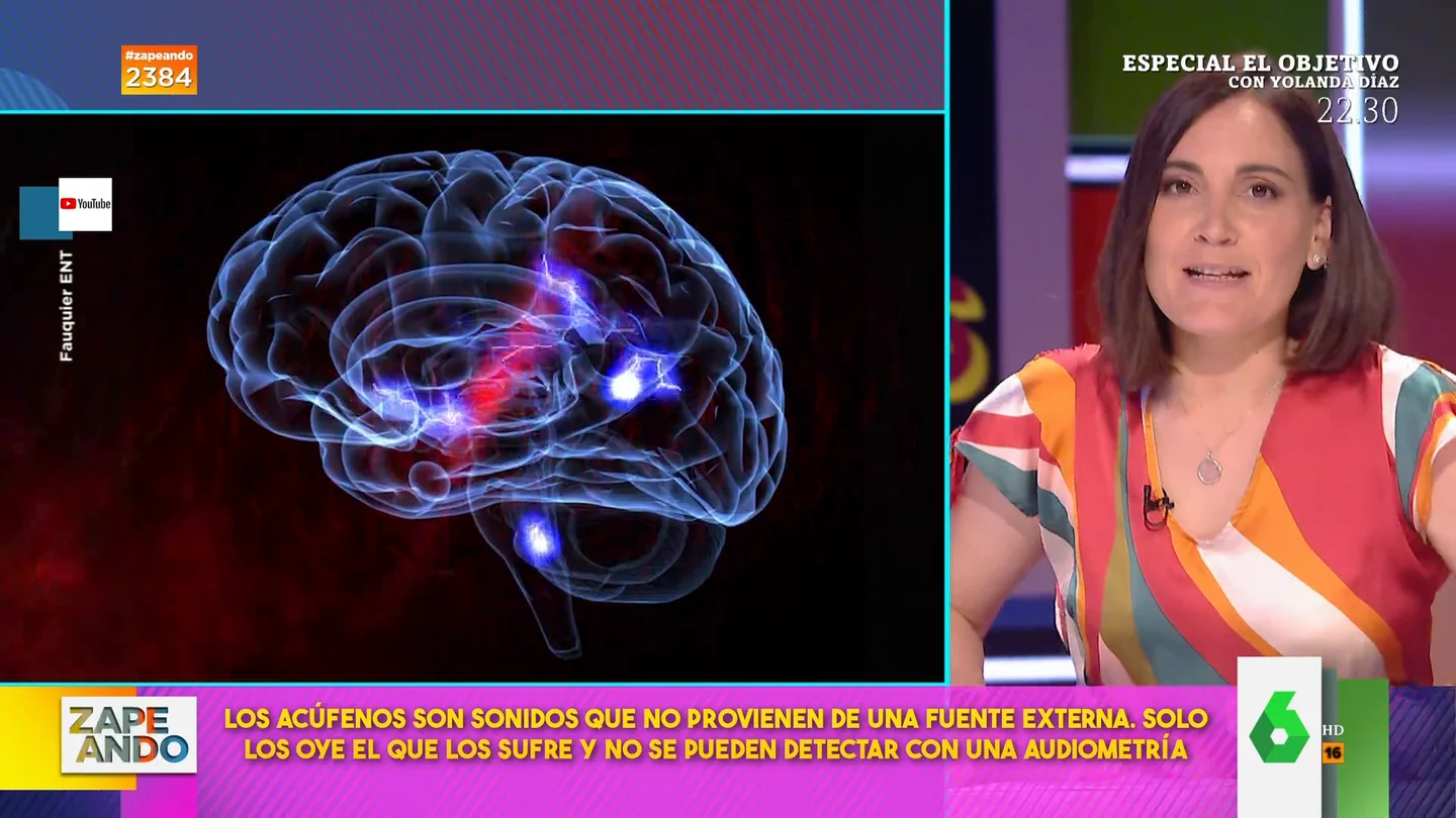 ¿Qué son los acúfenos? Boticaria García aclara por qué aparecen ¿Qué son los acúfenos? Boticaria García aclara por qué aparecen