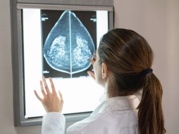 Imagen de una mamografía. 