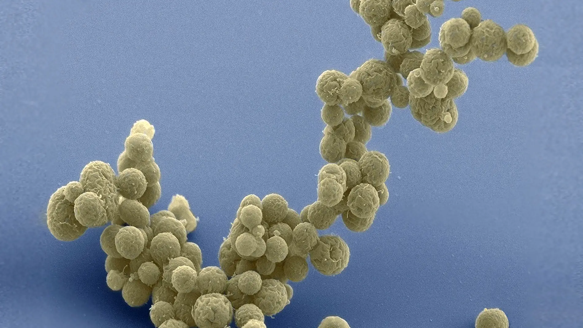 Mycoplasma mycoides simplificada de forma sintética
