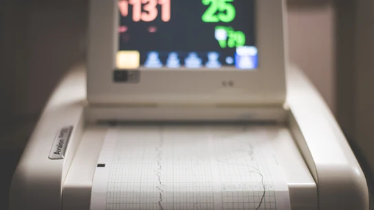 Un ecógrafo, la herramienta con la que se diagnostica, entre otra cosas, el embarazo Un ecógrafo, la herramienta con la que se diagnostica, entre otra cosas, el embarazo