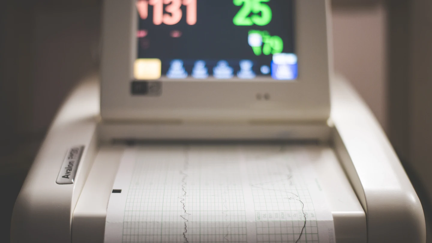 Un ecógrafo, la herramienta con la que se diagnostica, entre otra cosas, el embarazo Un ecógrafo, la herramienta con la que se diagnostica, entre otra cosas, el embarazo