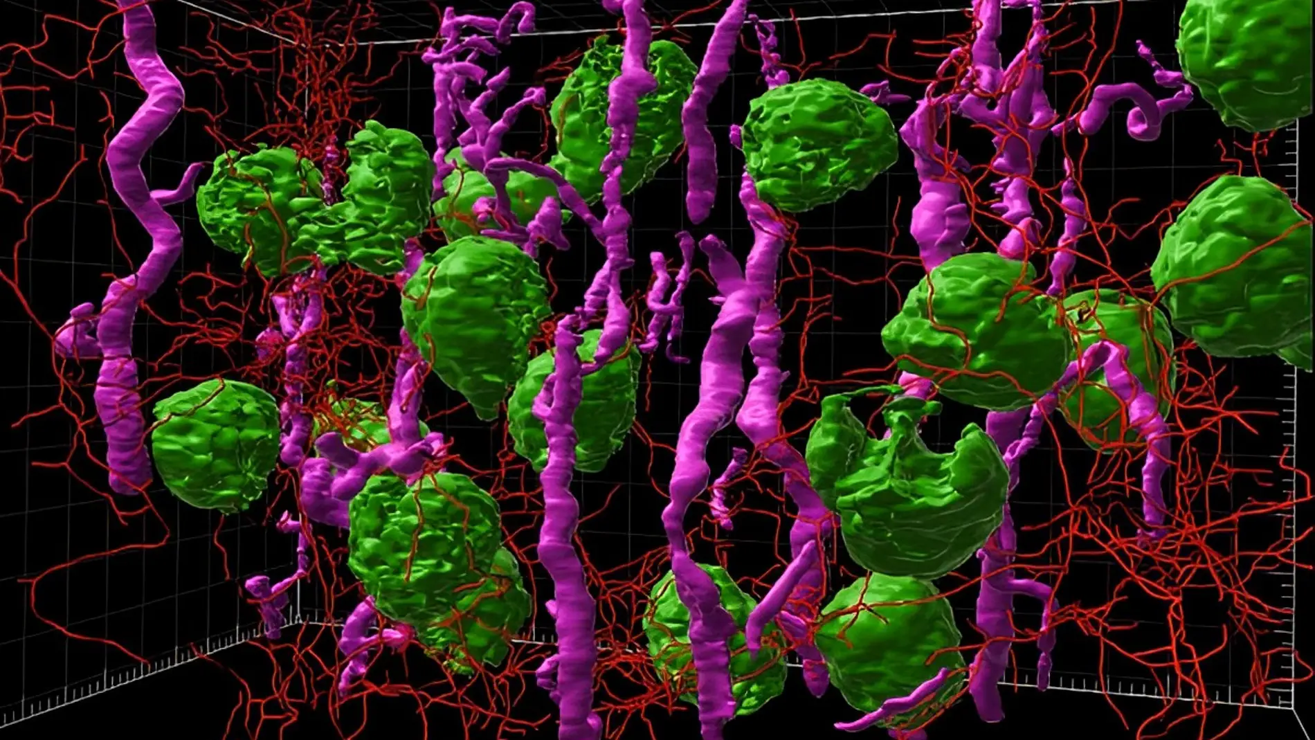 Imagen de microscopía de lámina de luz renderizada en 3D de corteza renal humana Imagen de microscopía de lámina de luz renderizada en 3D de corteza renal humana