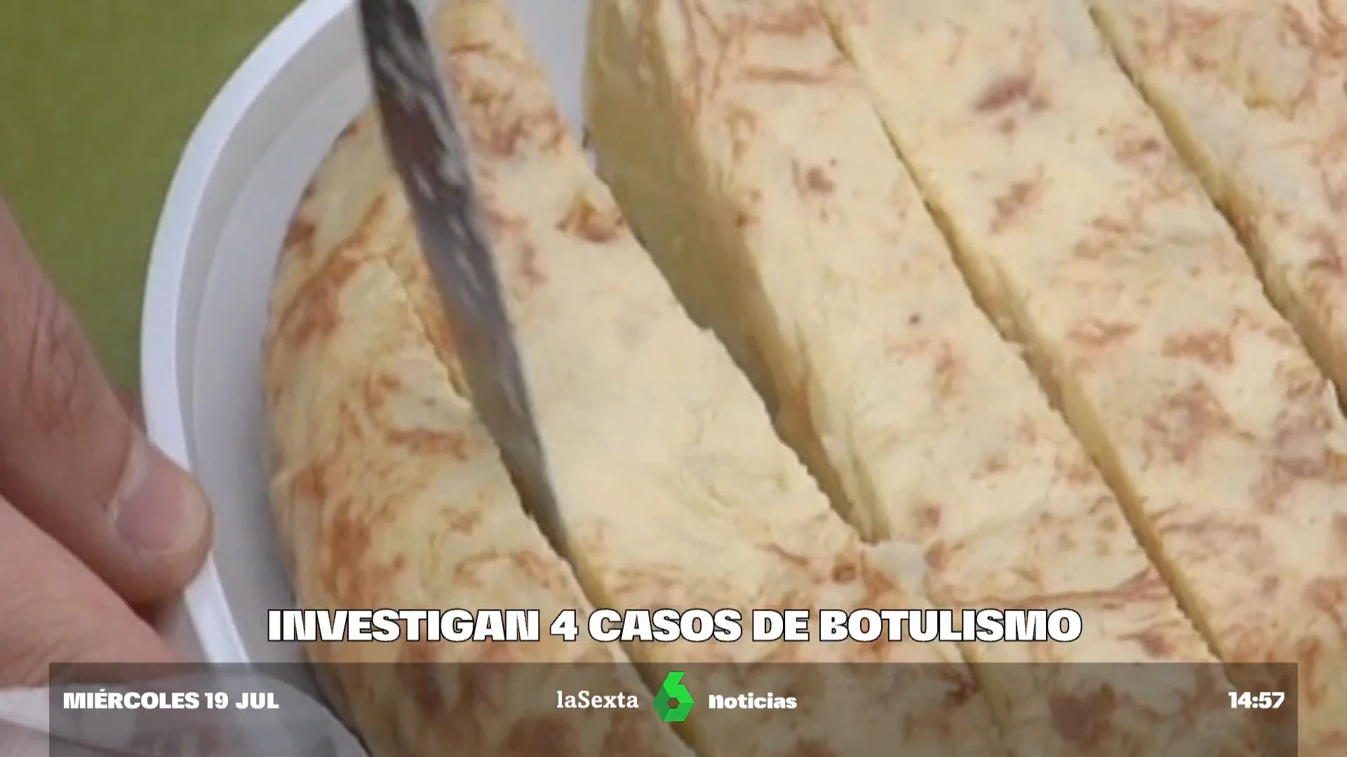 botulismo