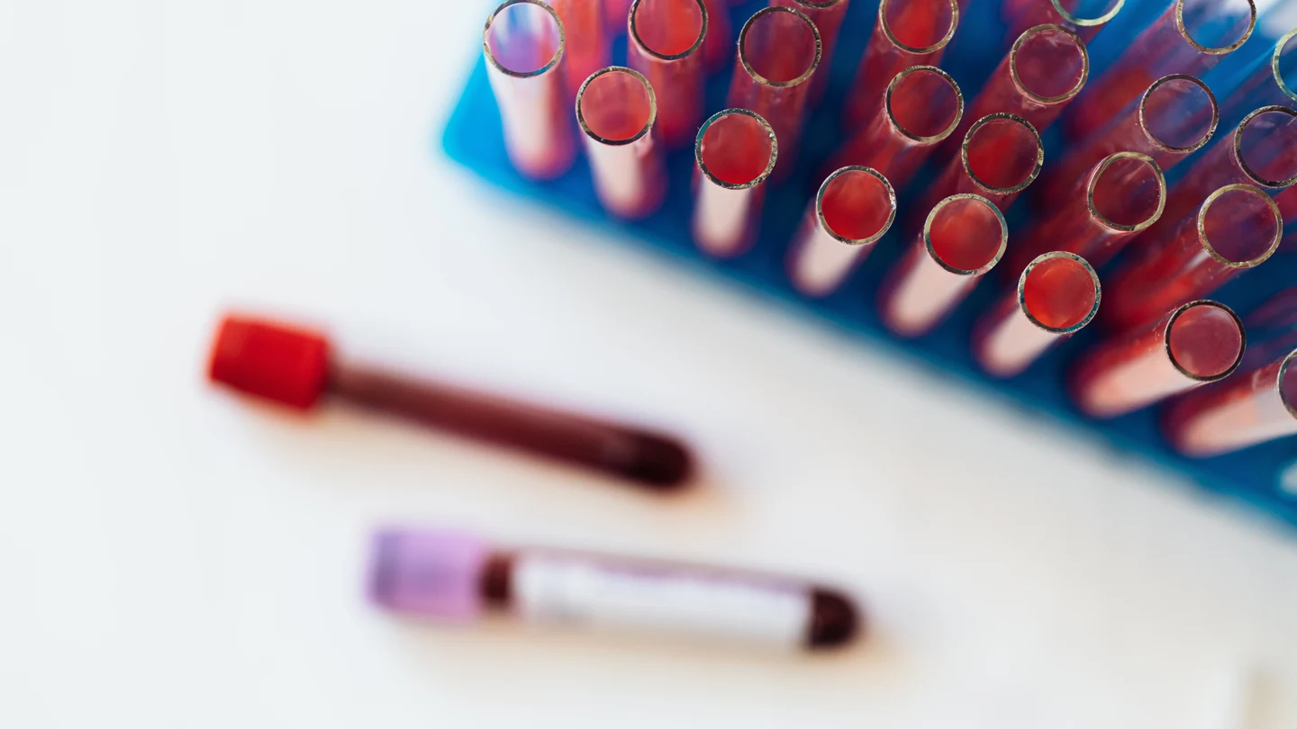 Cómo bajar el cortisol rápido Cómo bajar el cortisol rápido