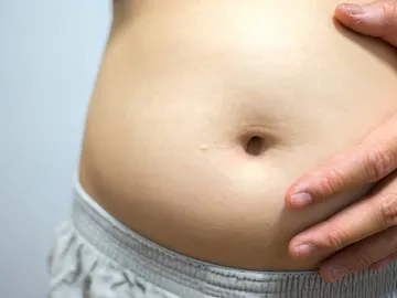 Hinchazón abdominal Hinchazón abdominal