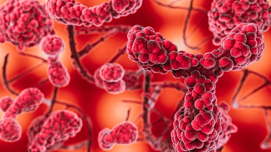 Qué es la talasemia y cuáles son los síntomas de este trastorno de la sangre Qué es la talasemia y cuáles son los síntomas de este trastorno de la sangre