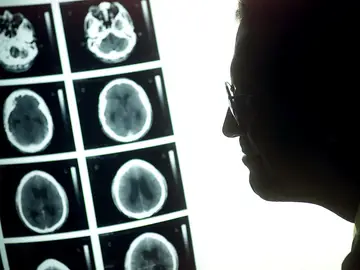 Identifican 4.000 variantes genéticas relacionadas con la estructura del cerebro Identifican 4.000 variantes genéticas relacionadas con la estructura del cerebro