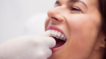 Los 3 "trucos" de una odontóloga para aliviar o reducir el bruxismo