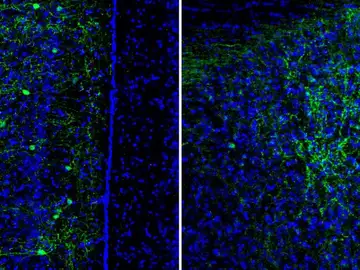 Neuronas CRH+ Neuronas CRH+