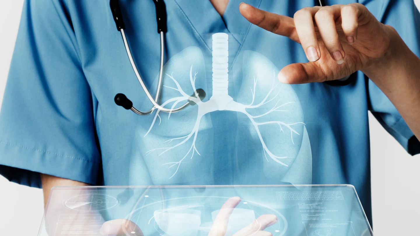 Cómo diagnosticar el cáncer de pulmón, Cómo diagnosticar el cáncer de pulmón, el tumor que sufrió María Jiménez y que más muertes causa en España