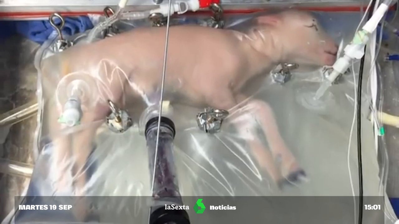 The ethics of trials with human fetuses in artificial wombs, under debate due to fears of the creation of baby macrofarms