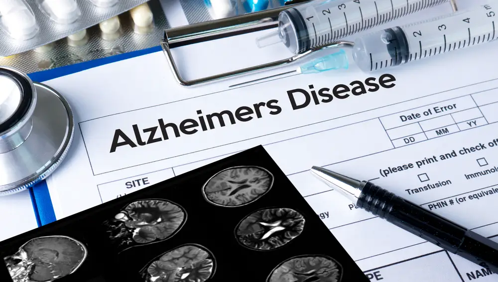 Alzheimer Alzheimer