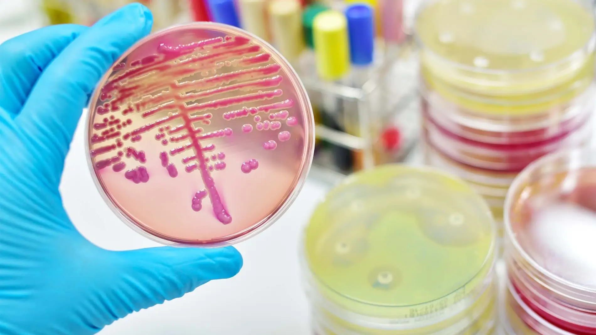 Un estudio aborda la funcion de las bacterias intestinales para desarrollar nuevos probioticos