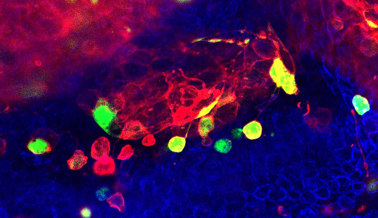 La inestabilidad cromosomica de las celulas cancerosas favorece la invasividad al danar el ADN