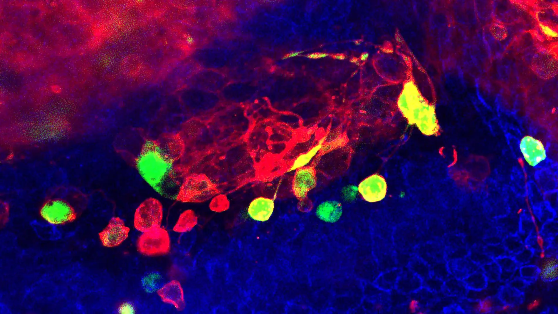 La inestabilidad cromosomica de las celulas cancerosas favorece la invasividad al danar el ADN La inestabilidad cromosomica de las celulas cancerosas favorece la invasividad al danar el ADN