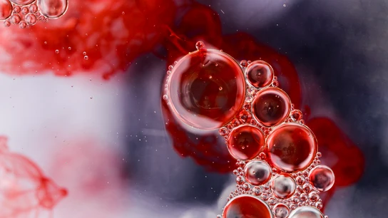 ¿Qué es la arteritis de Takayasu? Síntomas y tratamiento de esta enfermedad reumática y autoinmune ¿Qué es la arteritis de Takayasu? Síntomas y tratamiento de esta enfermedad reumática y autoinmune