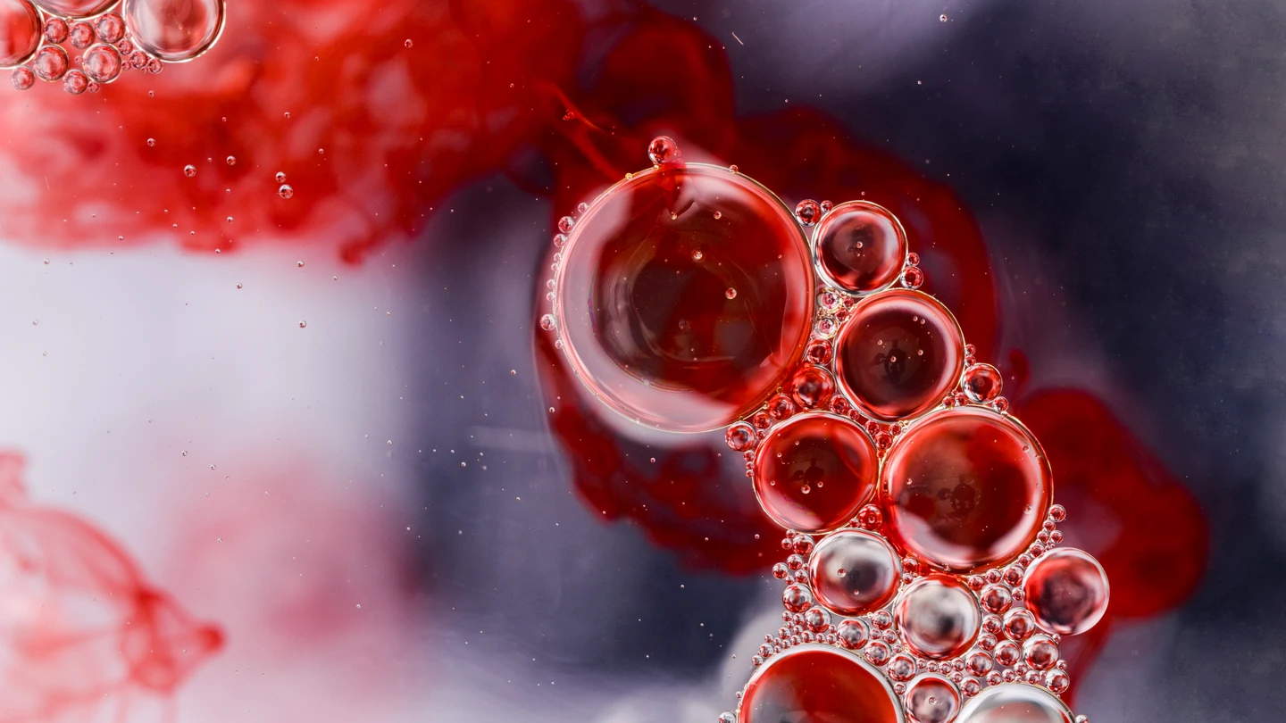 ¿Qué es la arteritis de Takayasu? Síntomas y tratamiento de esta enfermedad reumática y autoinmune ¿Qué es la arteritis de Takayasu? Síntomas y tratamiento de esta enfermedad reumática y autoinmune