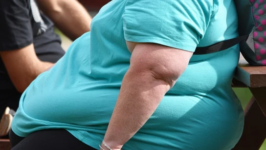 Empatía y humanización para combatir la gordofobia: "Los pacientes no escogen la obesidad" Empatía y humanización para combatir la gordofobia: "Los pacientes no escogen la obesidad"