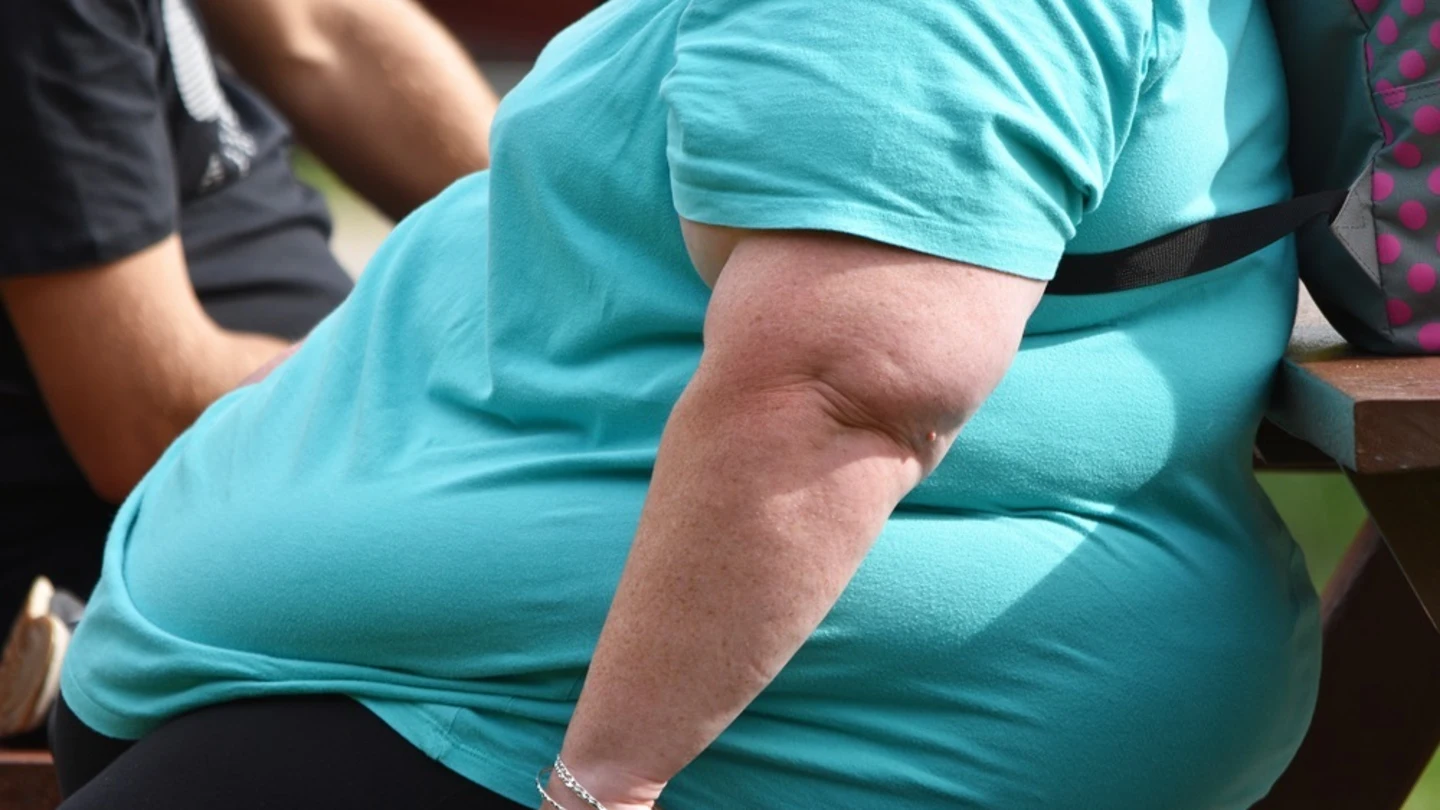 Empatía y humanización para combatir la gordofobia: "Los pacientes no escogen la obesidad" Empatía y humanización para combatir la gordofobia: "Los pacientes no escogen la obesidad"
