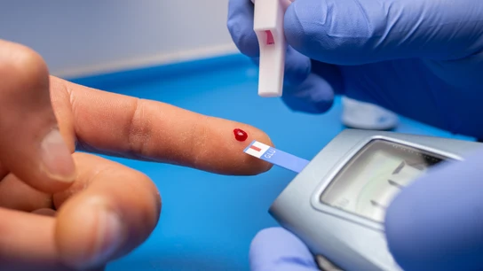 Cómo saber si tienes diabetes tipo 2: la mitad de las personas que la padecen no ha sido diagnosticadas Cómo saber si tienes diabetes tipo 2: la mitad de las personas que la padecen no ha sido diagnosticadas