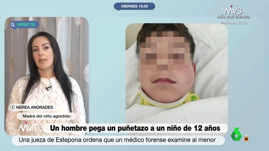 Nerea, la madre del niño de 12 años al que un vecino adulto le dio un puñetazo Nerea, la madre del niño de 12 años al que un vecino adulto le dio un puñetazo