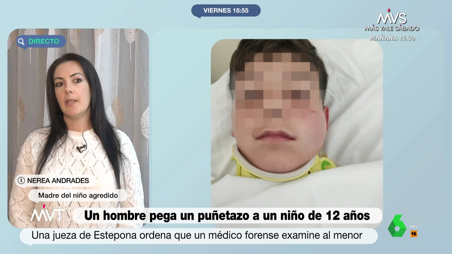 Nerea, la madre del niño de 12 años al que un vecino adulto le dio un puñetazo Nerea, la madre del niño de 12 años al que un vecino adulto le dio un puñetazo