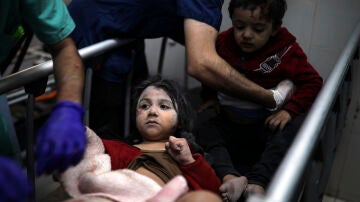 Niños palestinos son atendidos tras un ataque de Israel sobre Gaza