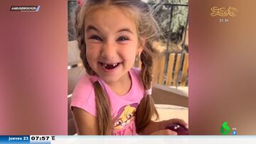 "El ratoncito Pérez tiene doble trabajo por culpa de esta manzana": una niña pierde de golpe dos dientes de leche