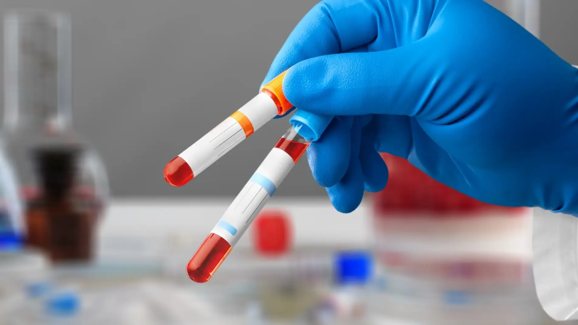 Análisis de sangre, envejecimiento, órganos Análisis de sangre, envejecimiento, órganos