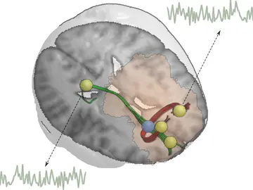materia blanca en el cerebro materia blanca en el cerebro