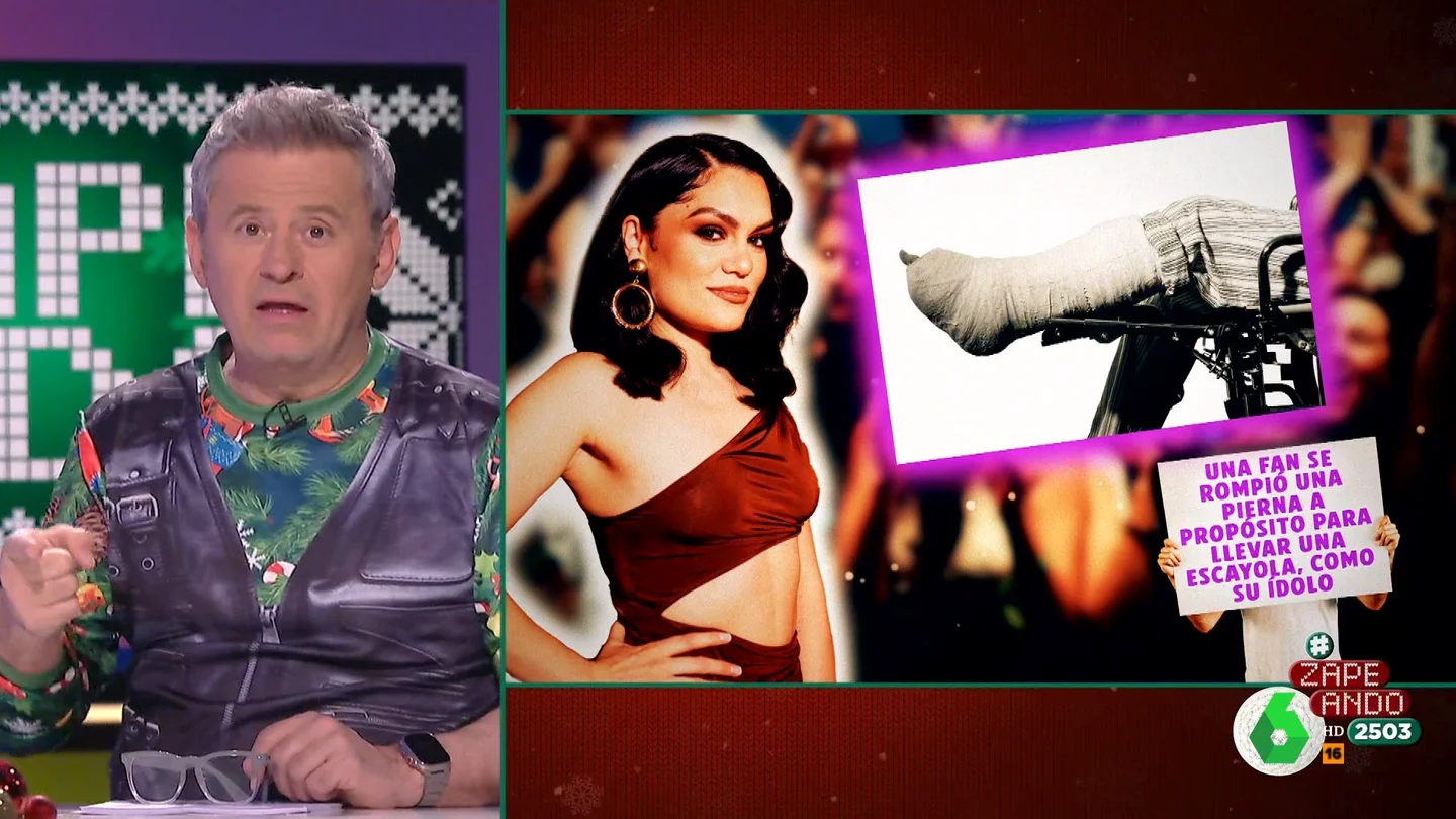 La locura de una fan de Jessie J: se rompió una pierna para parecerse a ella La locura de una fan de Jessie J: se rompió una pierna para parecerse a ella