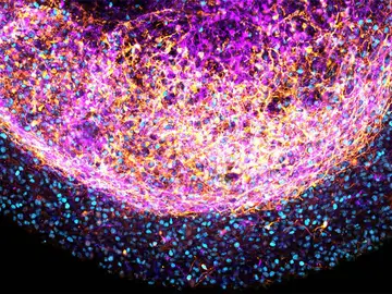 Imagen ampliada de una parte de un organoide cerebral fetal humano Imagen ampliada de una parte de un organoide cerebral fetal humano