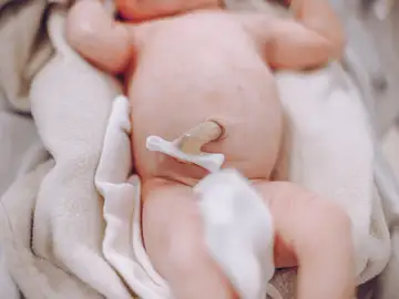 Cordón umbilical Cordón umbilical