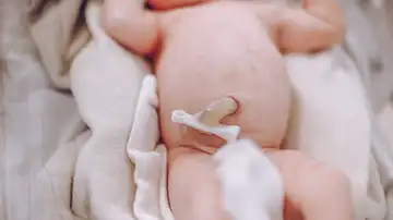 Cordón umbilical Cordón umbilical