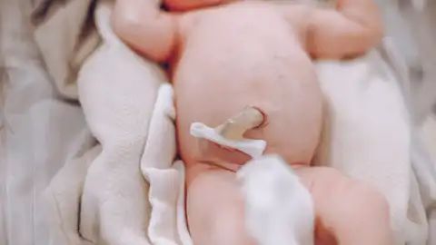 Cordón umbilical Cordón umbilical