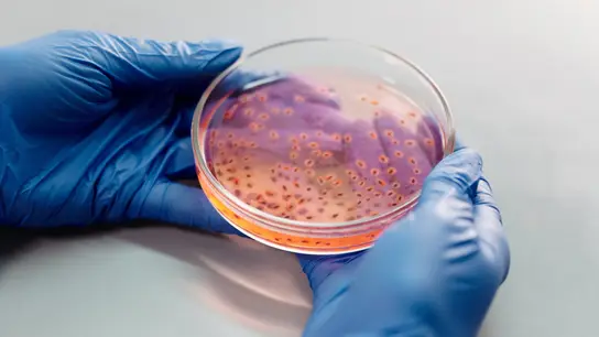 Superbacterias Superbacterias