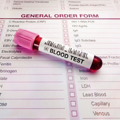 Resultados de an&aacute;lisis de sangre