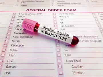 Resultados de análisis de sangre Resultados de análisis de sangre