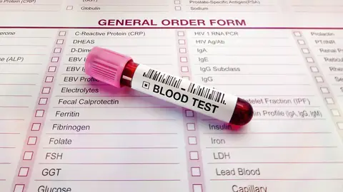 Resultados de análisis de sangre Resultados de análisis de sangre