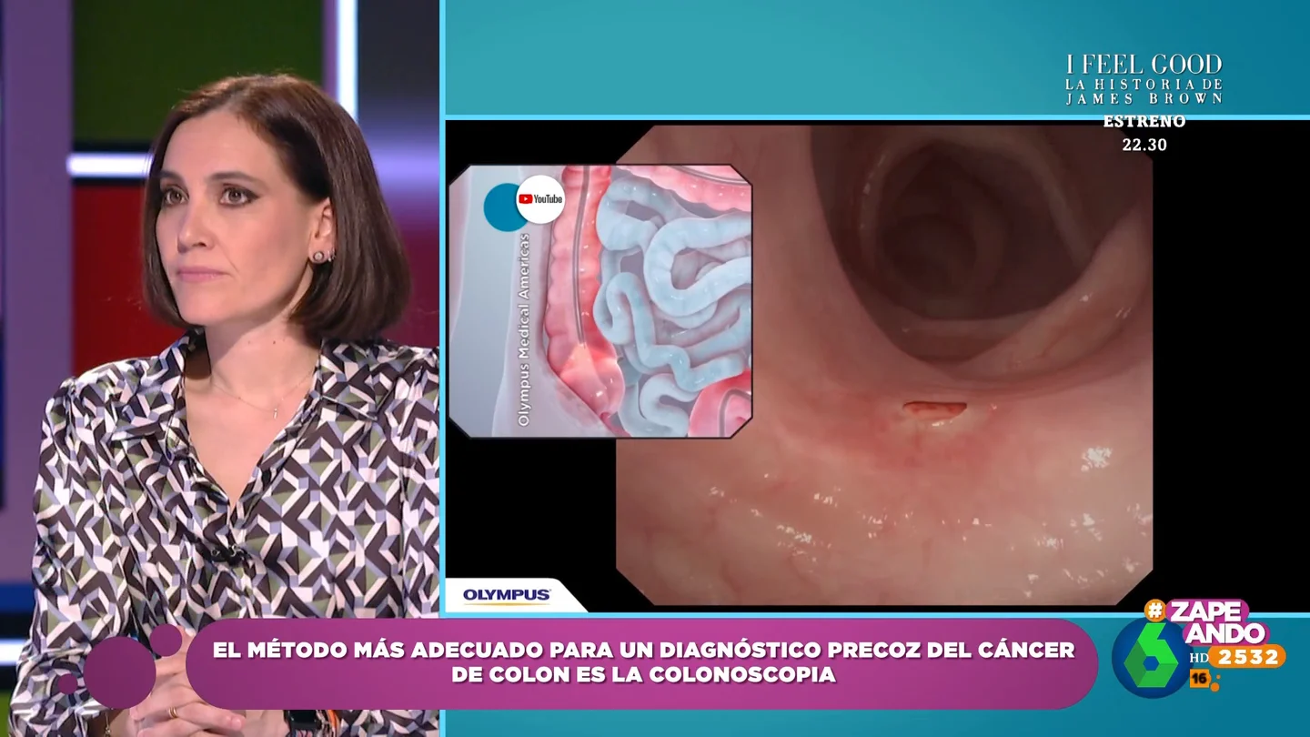 ¿Por qué es importante hacerse colonoscopias? Boticaria García expone la importancia de esta prueba médica ¿Por qué es importante hacerse colonoscopias? Boticaria García expone la importancia de esta prueba médica