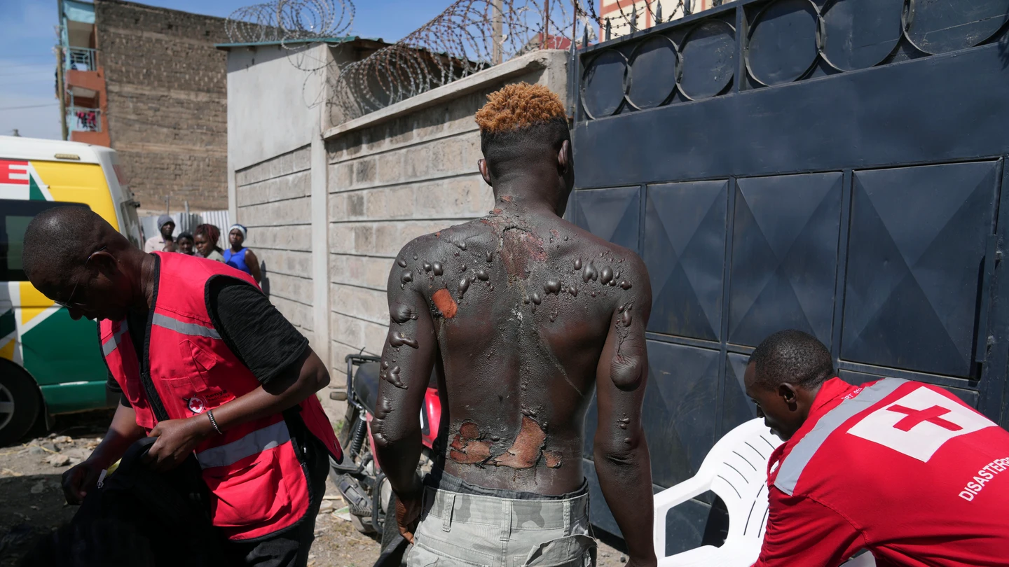 Un hombre herido es atendido en el lugar de una explosión, en Nairobi, Kenia, el viernes 2 de febrero de 2024 Un hombre herido es atendido en el lugar de una explosión, en Nairobi, Kenia, el viernes 2 de febrero de 2024