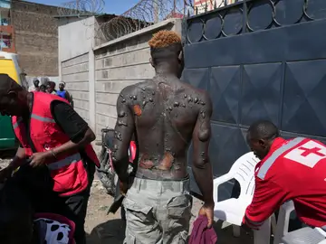 Un hombre herido es atendido en el lugar de una explosión, en Nairobi, Kenia, el viernes 2 de febrero de 2024