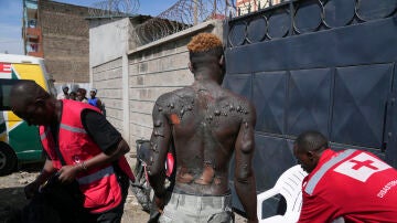Un hombre herido es atendido en el lugar de una explosión, en Nairobi, Kenia, el viernes 2 de febrero de 2024