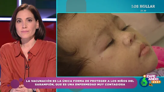 Fiebre alta o sarpullidos: Boticaria García explica los síntomas más habituales del sarampión Fiebre alta o sarpullidos: Boticaria García explica los síntomas más habituales del sarampión