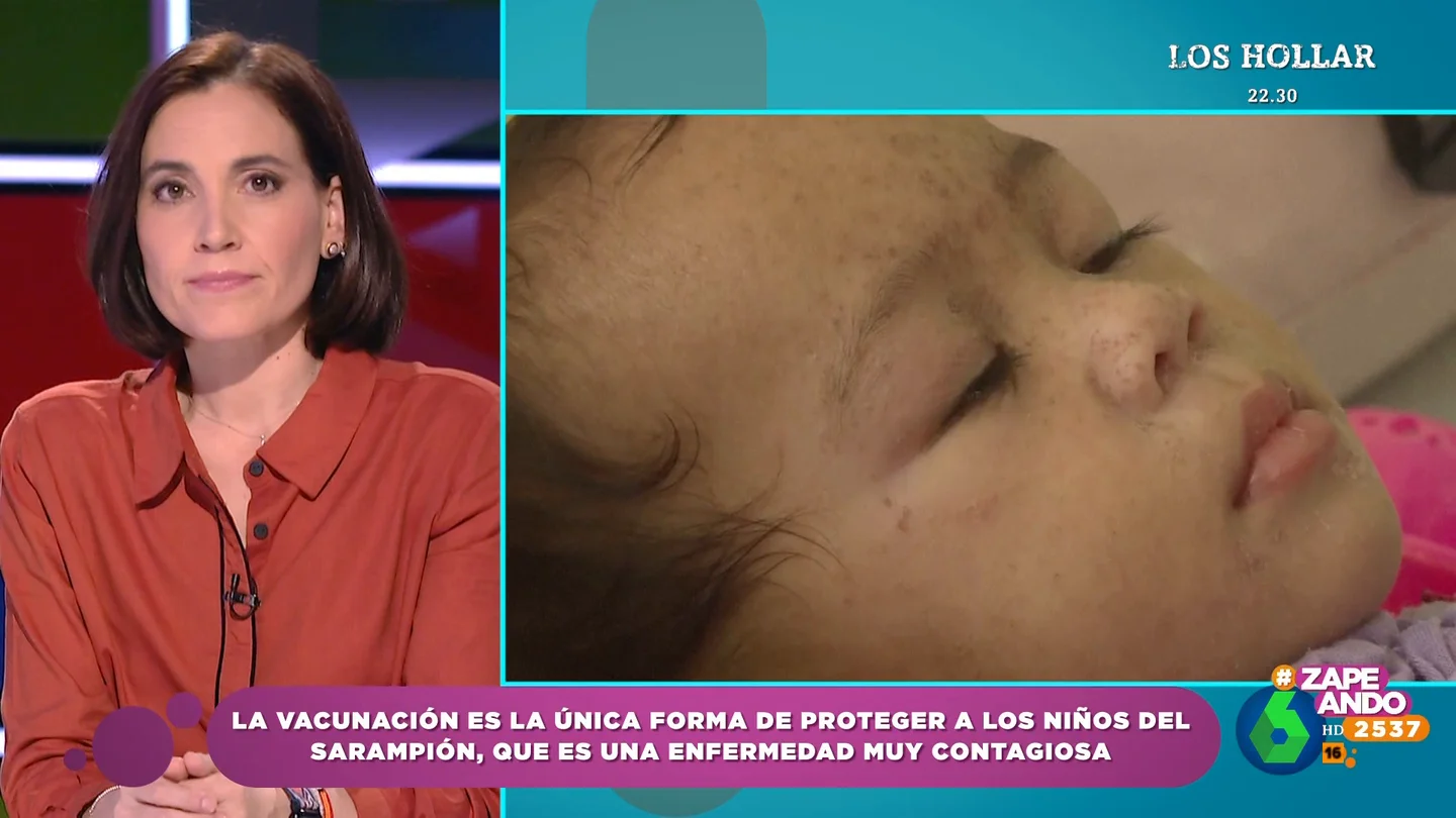 Fiebre alta o sarpullidos: Boticaria García explica los síntomas más habituales del sarampión Fiebre alta o sarpullidos: Boticaria García explica los síntomas más habituales del sarampión