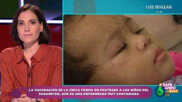 Fiebre alta o sarpullidos: Boticaria García explica los síntomas más habituales del sarampión