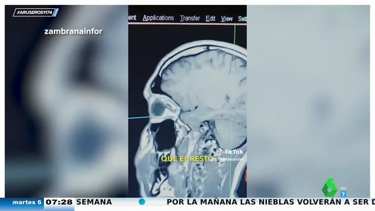 Un estudio revela las diferencias en la materia gris de los hijos únicos: así es tu cerebro si no tienes hermanos Un estudio revela las diferencias en la materia gris de los hijos únicos: así es tu cerebro si no tienes hermanos