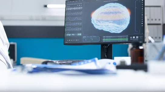 Una resonancia magnética, una de las pruebas que se utilizan en la epilepsia. Una resonancia magnética, una de las pruebas que se utilizan en la epilepsia.