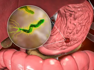 Bacteria Helicobacter pylori Bacteria Helicobacter pylori